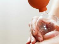 Cupping masaža - efikasno mršavljenje abdomena i oslobađanje od celulita Medicinski cupping za mršavljenje